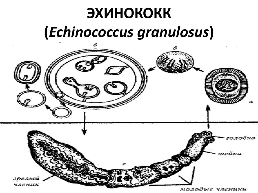 Диагностика эхинококкоза на УЗИ